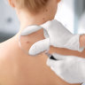 New research has confirmed some melanoma’s will never cause an issue, reiterating the growing issue of cancer overdiagnosis.