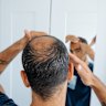Some hair loss treatments have been linked to lower sperm counts.