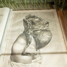 The anatomy of the human gravid uterus exhibited in figures, William Hunter, 1815, is on display in the State LIbrary of NSW’s new exhibition Kill or Cure.