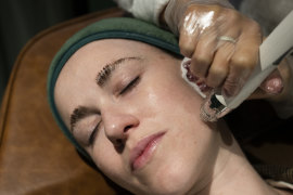 A customer receiving a skin needling treatment at the Skin Bar in Double Bay. The treatment promotes collagen growth.