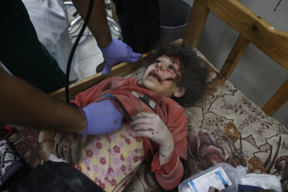 A Palestinian child wounded in the Israeli bombardment of the Gaza Strip is treated in Khan Younis.