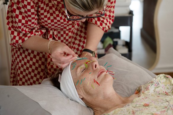 Elizabeth Cullen performing cosmetic acupuncture at her Sydney studio. 