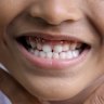 Why your toddler is due a dental visit (and why you’re probably brushing their teeth wrong too)