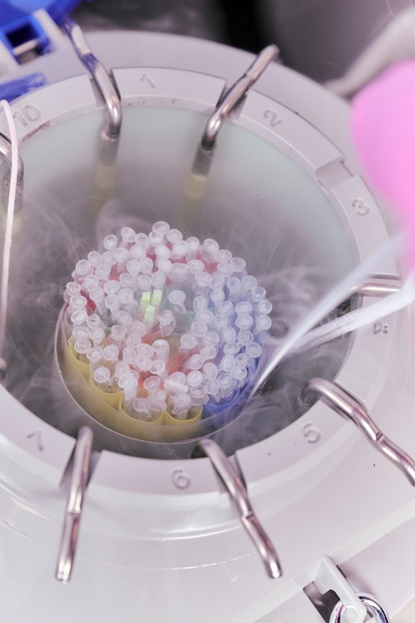 Egg freezing at Number One Fertility clinic in Melbourne.