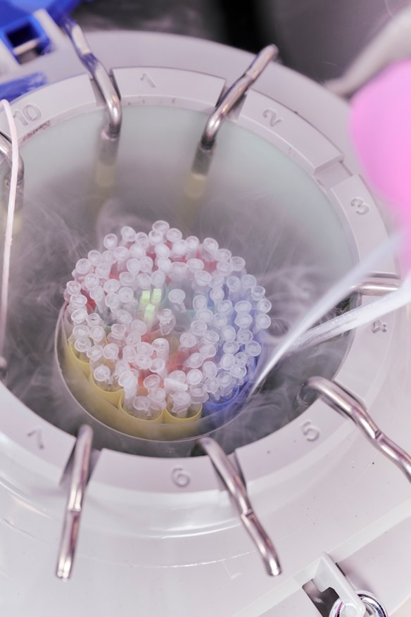 Egg freezing at Number One Fertility clinic in Melbourne.