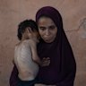 Palestinian child Yazan Abu Foul, 2, who is suffering from severe malnutrition, is held by his mother, Naima.