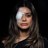 Former Greens candidate Hannah Thomas has been warned she will likely never regain full vision in her right eye after an injury she suffered when police broke up an anti-Israel protest last month.