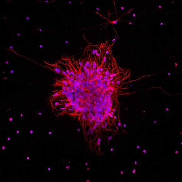 A brain organoid through the microscope, created with stem cells.