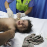 ‘Kids are traumatised’: Gaza hospitals overwhelmed with patients