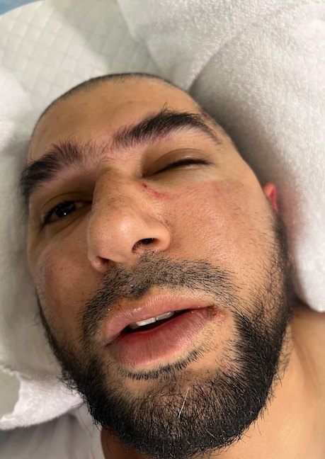 Family launches fundraiser for Perth Uber driver injured in violent ...