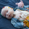 We just want to take our baby home: The rare syndrome keeping four-month-old Jasper in hospital
