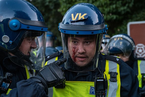 Blood runs down the cheek of an officer following a scuffle with protesters outside the Bell Hotel in Epping, England. 