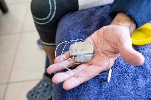 A spinal cord stimulator.