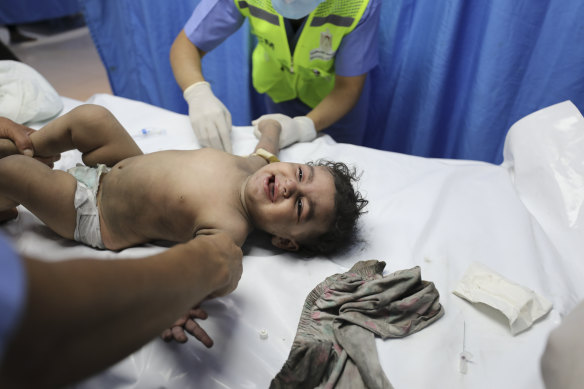 A Palestinian child wounded in the Israeli strikes is brought to Shifa Hospital in Gaza City.