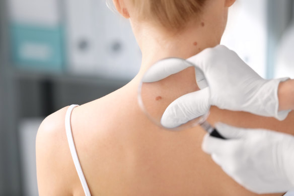 Hundreds of melanoma cases are being missed in Victoria.