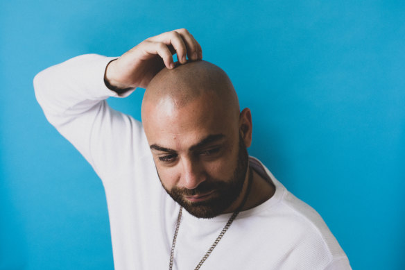 Sydney man Gray Roberts has had thousands of dots of pigment tattooed on his scalp to resemble hair follicles.