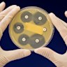 Medical research institutes are grappling with cuts to their research grants as a result of US changes. 