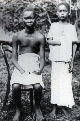 Amputation in the so-called Congo Free State, the personal property of King Leopold II, in 1900. 