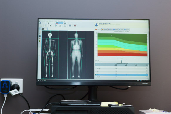 Berry’s DEXA scan showing her body fat and bone density.