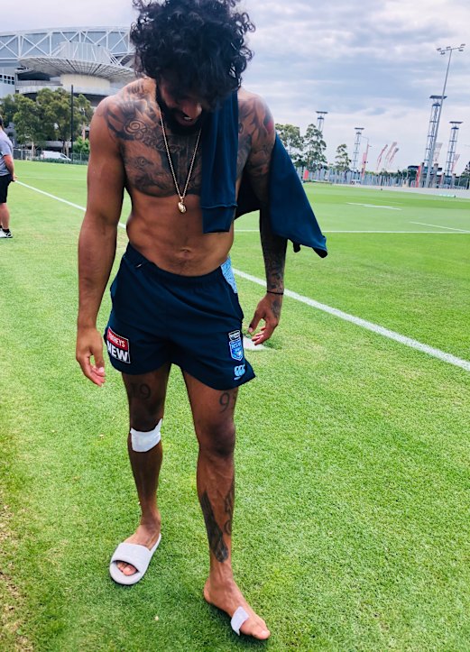 The winger says he will play next Wednesday and just needs some time off his foot.