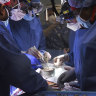 Members of the surgical team perform the transplant of a pig heart into patient David Bennett in Baltimore.