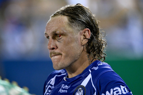 Terminator: Tough Bulldog Kurt Mann with the black (and red) eye he first suffered in round one.