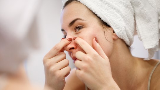 While squeezing blackheads can be satisfying, professional extraction is the safest option.