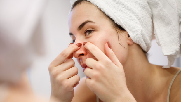 Tempted to squeeze your blackheads? Do this instead