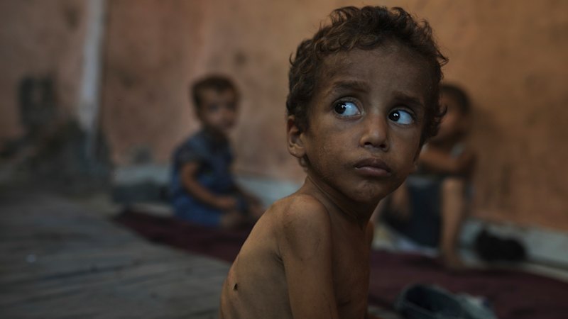 Israel’s denials don’t change the fact that children are starving