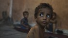 Yazan Abu Ful, a 2-year-old malnourished child, sits at his family home in the Shati refugee camp in Gaza City on Wednesday, July 23, 2025. (AP Photo/Jehad Alshrafi)