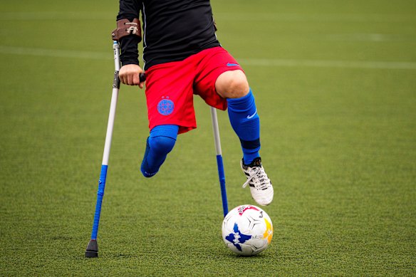 Marian Sacacol controls the ball during the first match between FCSB and Dinamo Bucuresti in the newly established National Amputee Soccer League, in Bucharest.