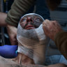 A soldier with a jaw wound who administered first aid to himself and was unable to leave his position for two days with this wound. Medics provide first aid at a stabilisation point near the frontline near the Kurakhove frontline, Donetsk Oblast, in eastern Ukraine.