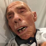 Kevin Fearnside's oral health declined rapidly when he went into an aged care facility. 