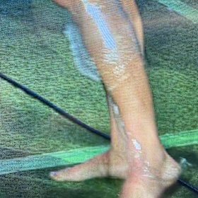 Nicho Hynes’ calf on ice after Origin I.