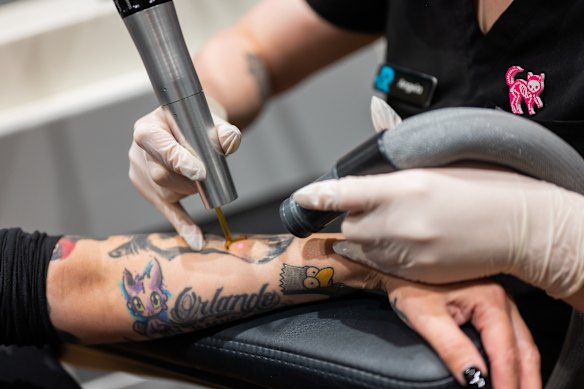 Global tattoo removal chain Removery says it’s seen 35 per cent growth in treatments in the past year.