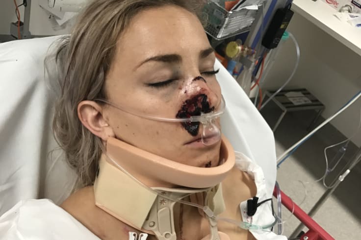 Caroline Buchanan in hospital in January after the crash.