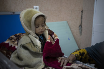 Guldana, 2 and malnourished, sits on a bed in the Indira Gandhi hospital in Kabul, Afghanistan, on Monday.