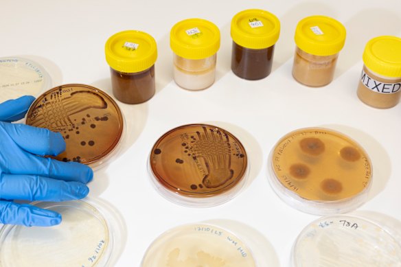 Se han probado varias mieles contra E. coli y estafilococos, que causan infecciones cutáneas resistentes a los medicamentos.