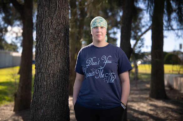 Kyla Hodges was diagnosed with alopecia areata six years ago and has a group chat with her friends called “Bald Baddies”. 