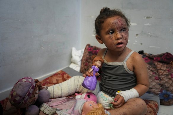 Layan Ibrahim Sahloul, 4, at Nasser hospital on Sunday with second-degree burns from an Israeli army strike on her home in Khan Yunis that killed her pregnant mother and two siblings.
