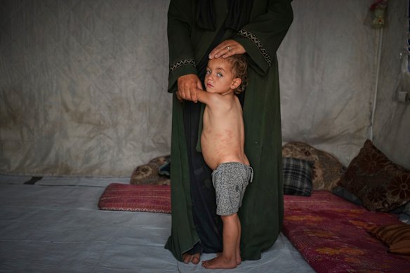 Two-year-old Mohammed Abu Hilal clings to his mother, Yasmine, inside their tent at the Muwasi camp for displaced Palestinians in Khan Younis, southern Gaza Strip, on Sunday.