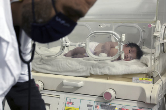 Bir doktor, Suriye'nin Afrin kentindeki çocuk hastanesinde bebek Aya'yı denetliyor.
