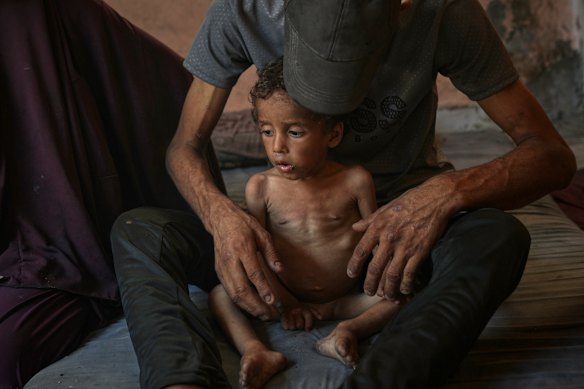 Yazan Abu Ful, a two-year-old malnourished child, sits with his father in the Shati refugee camp in Gaza City.
