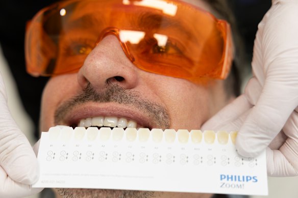 Dental hygienist Charmaine Maher holds a “shade guide”  against Carre’s teeth.