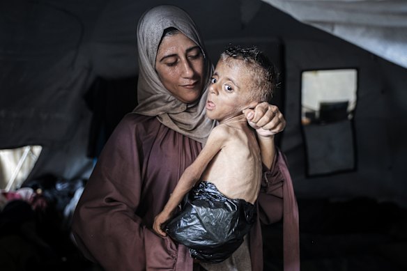 Trump has failed to bring peace to Gaza, where children like 18-month-old Muhammad Zakariya Ayyoub al-Matouq has gone from 9kg to 6kg since an Israeli blockade began.