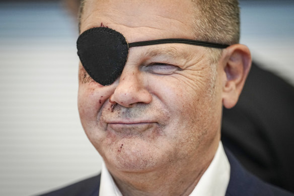 Olaf Scholz tweets picture of himself with eye patch