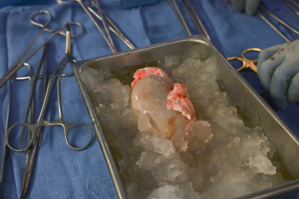 The pig kidney sits on ice, awaiting transplantation.