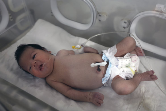 A baby girl born under the rubble caused receives treatment in an incubator at a children’s hospital in in the town of Afrin, Aleppo province, Syria. 