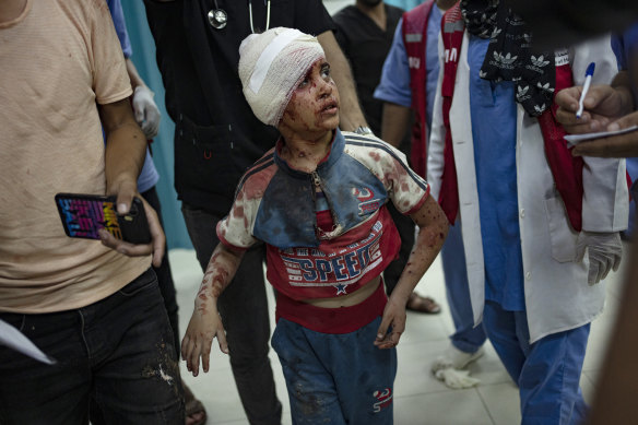 A Palestinian child, wounded in the Israeli bombardment of the Gaza Strip, is brought to a hospital in Khan Younis.
