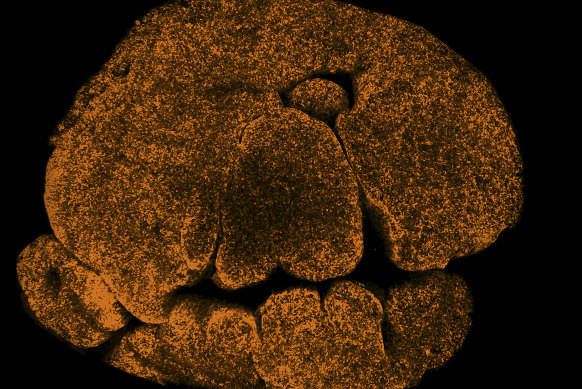 These orange dots show the cells of the thymus, illuminated this way to allow an image of the organ to be taken.